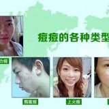 修补养护问题肌肤